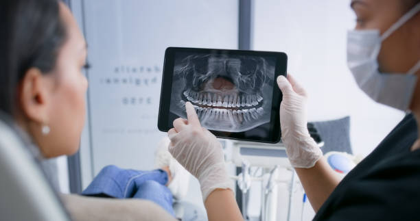 Licensed Dental Implants service in Wharton, NJ - Smile Center Dentistry