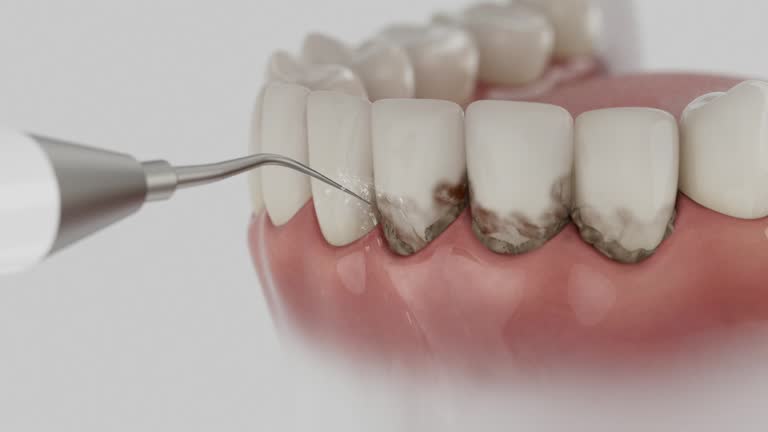 Reliable Dental Implants contractor in Wharton, NJ by Smile Center Dentistry